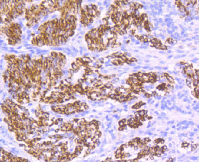 Anti-Desmin Antibody (2D838)