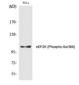 Anti-Phospho-eEF2K (Ser366) Polyclonal Antibody