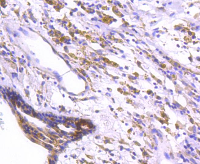 Anti-DARPP-32 Antibody (1B13)