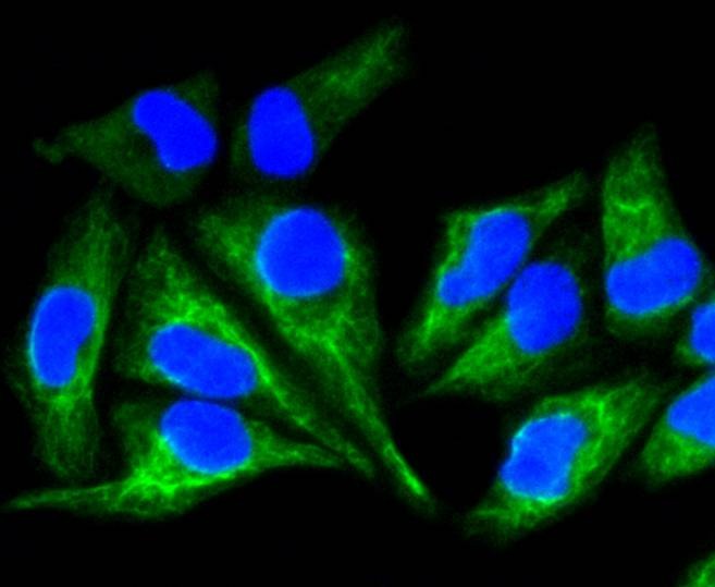 Anti-KRT8/18 Antibody (6E645)