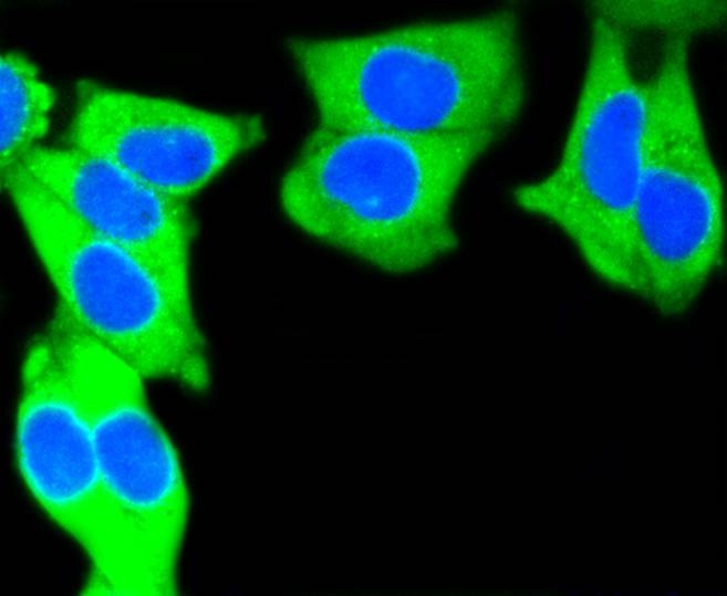 Anti-KRT7 Antibody (4X26)