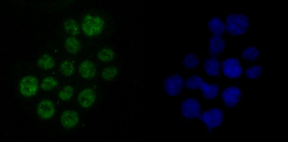 Anti-DDX5 Antibody (7B467)
