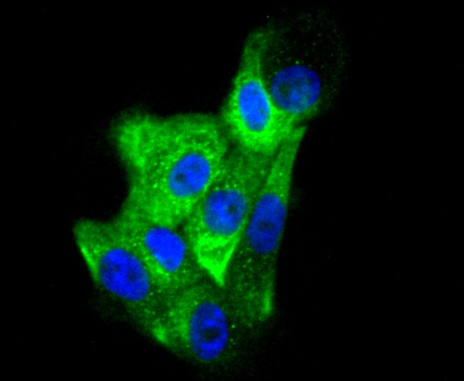 Anti-KRT6A Antibody (4G523)