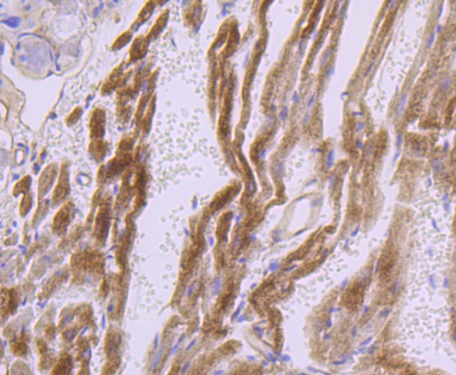 Anti-Dysferlin Antibody (4C391)