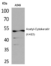 Anti-Acetyl-KRT8 (Lys483) Polyclonal Antibody
