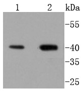 Anti-OPRD1 Antibody (4W773)