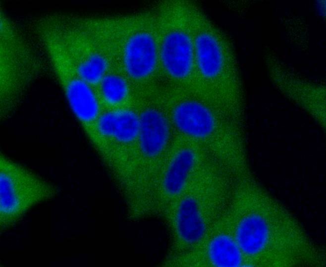 Anti-Dnmt3a Antibody (1X206)