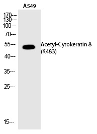 Anti-Acetyl-KRT8 (Lys483) Polyclonal Antibody