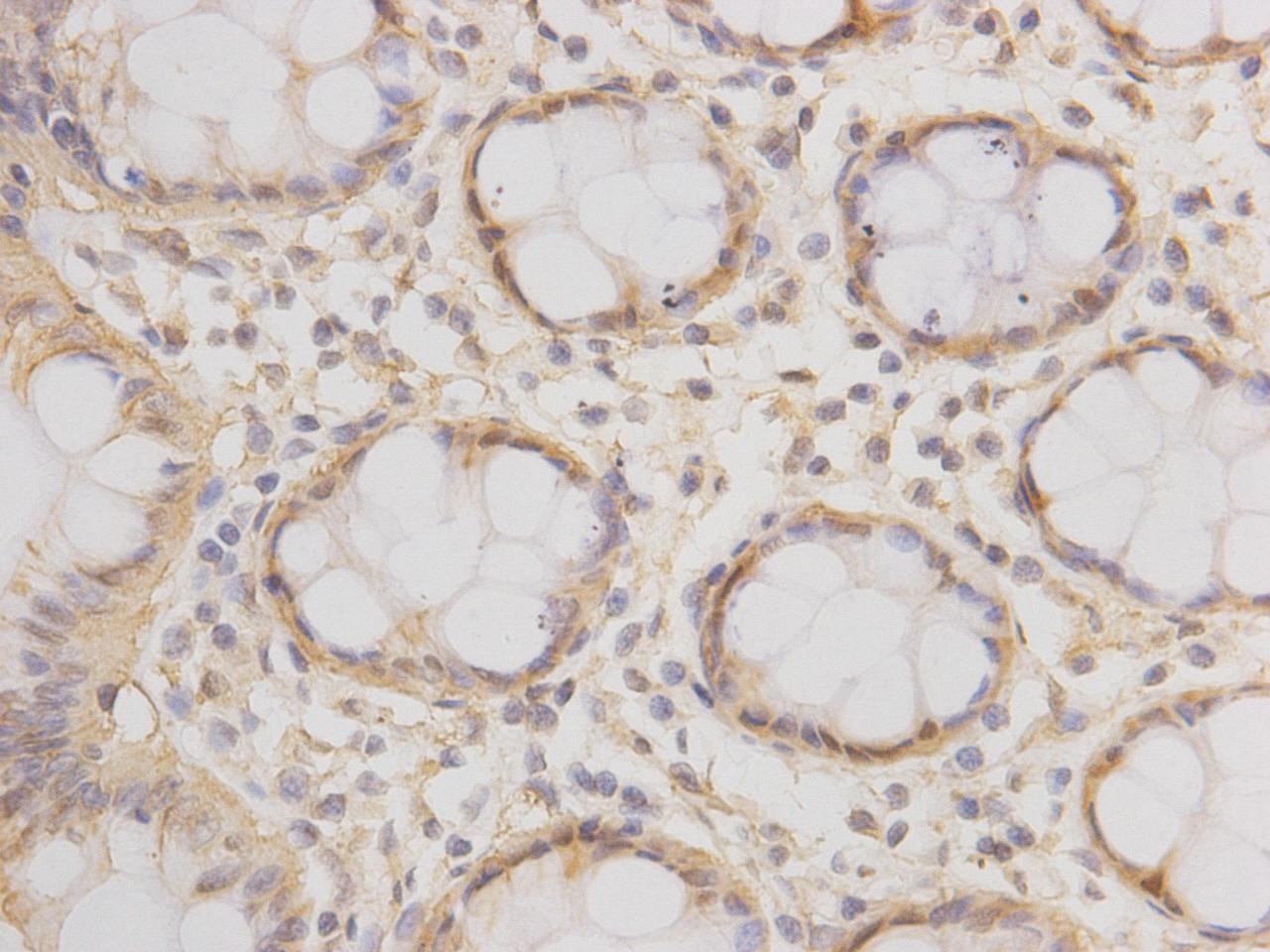 Anti-PRKDC Antibody (4T952)