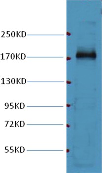 Anti-EGFR Antibody (4I461)