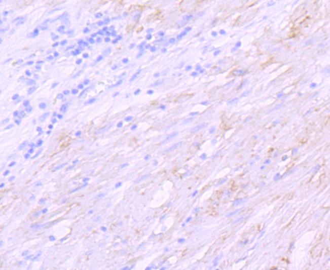 Anti-delta Sarcoglycan Antibody (5T99)