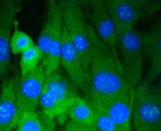 Anti-Dnmt3a Antibody (1X206)