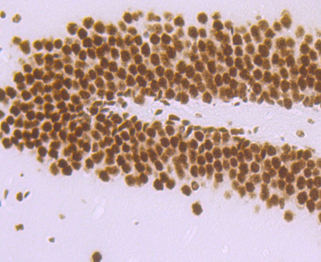 Anti-DDX5 Antibody (7B467)