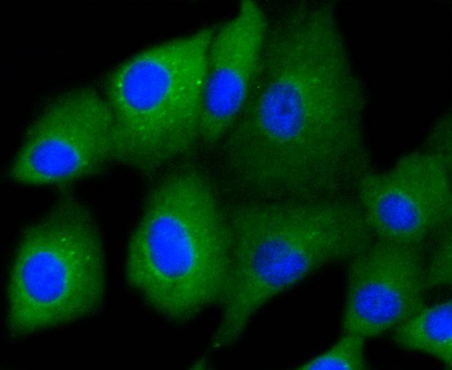 Anti-KRT7 Antibody (4X26)