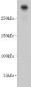 Anti-PRKDC Antibody (4T952)