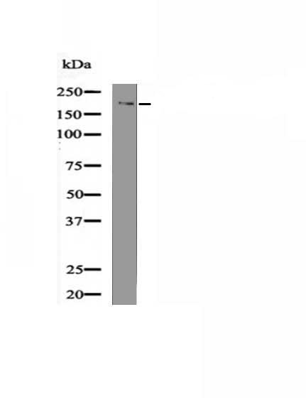Anti-Phospho-DNMT1 (Ser958) Polyclonal Antibody