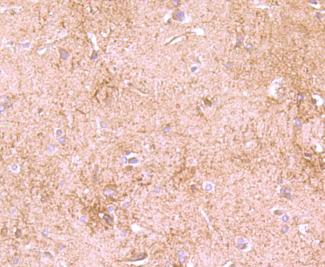 Anti-DDX6 Antibody (4T946)
