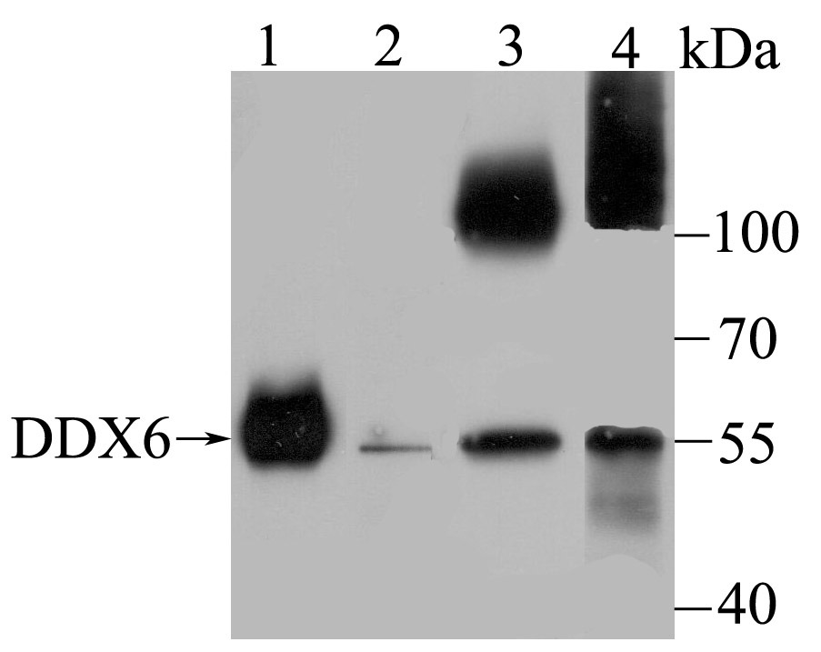 Anti-DDX6 Antibody (4T946)