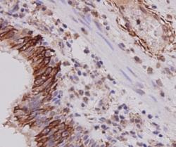 Anti-KRT7 Antibody (8D469)