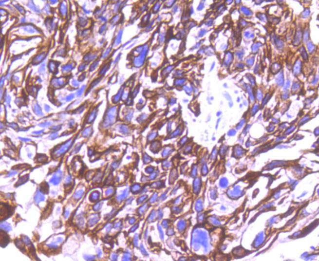 Anti-KRT8/18 Antibody (6E645)