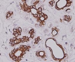 Anti-KRT7 Antibody (8D469)