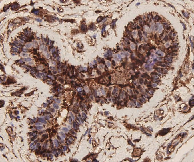 Anti-EpCAM/TROP1 Antibody (9A610)