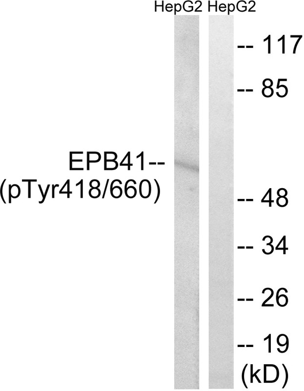 Anti-Phospho-EPB41 (Tyr660, 418) Polyclonal Antibody