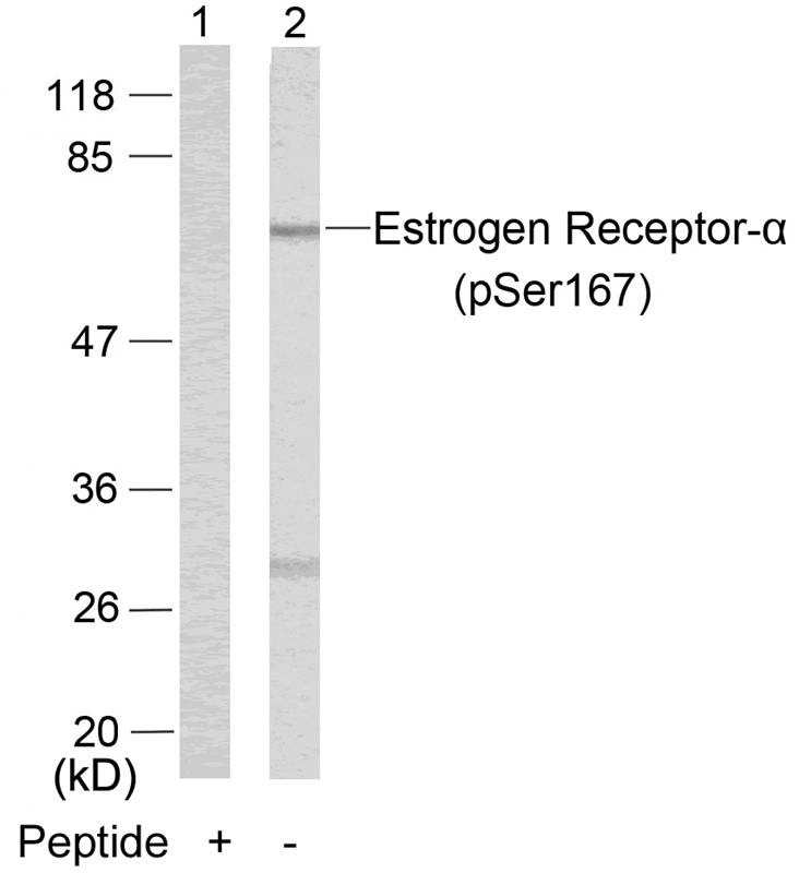 Anti-Phospho-ER alpha (Ser167) Polyclonal Antibody
