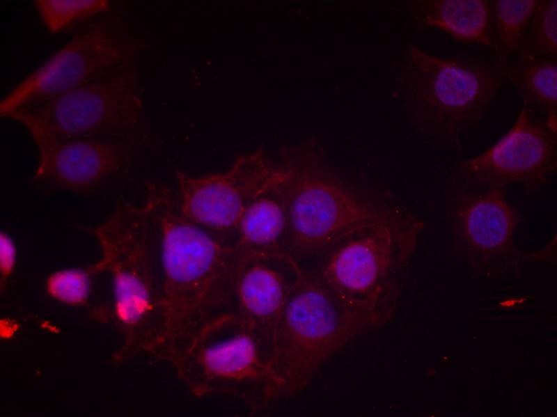 Anti-Phospho-ER alpha (Ser118) Polyclonal Antibody