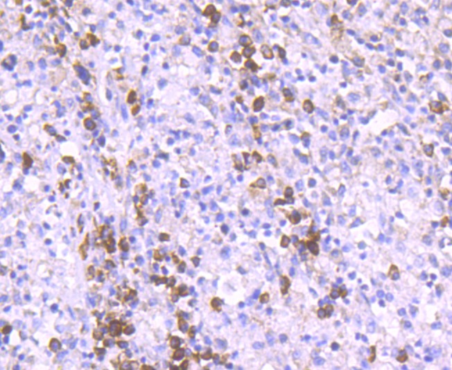 Anti-Epac1 Antibody (3T871)