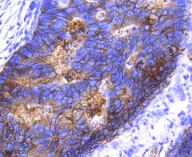 Anti-EpCAM/TROP1 Antibody (1I547)