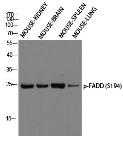 Anti-Phospho-FADD (Ser194) Polyclonal Antibody