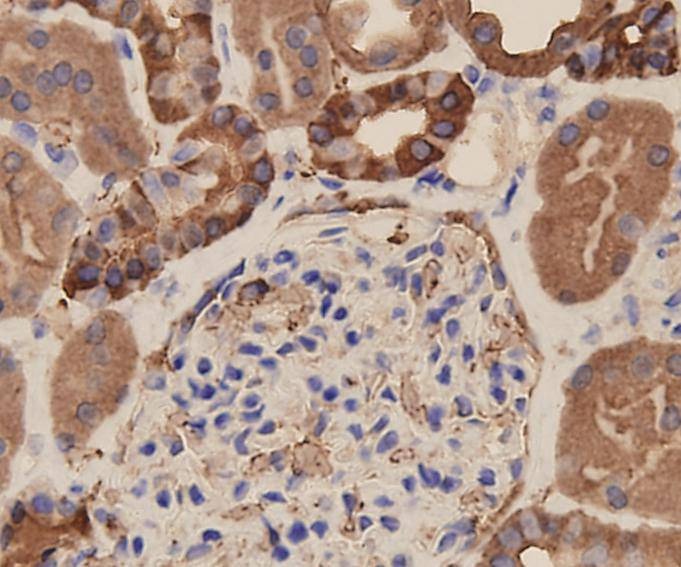 Anti-EpCAM/TROP1 Antibody (9A610)