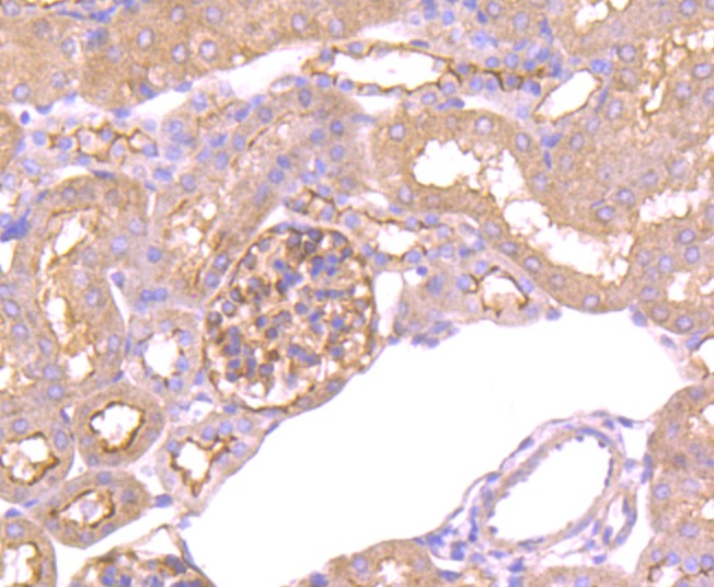 Anti-Epac1 Antibody (3T871)