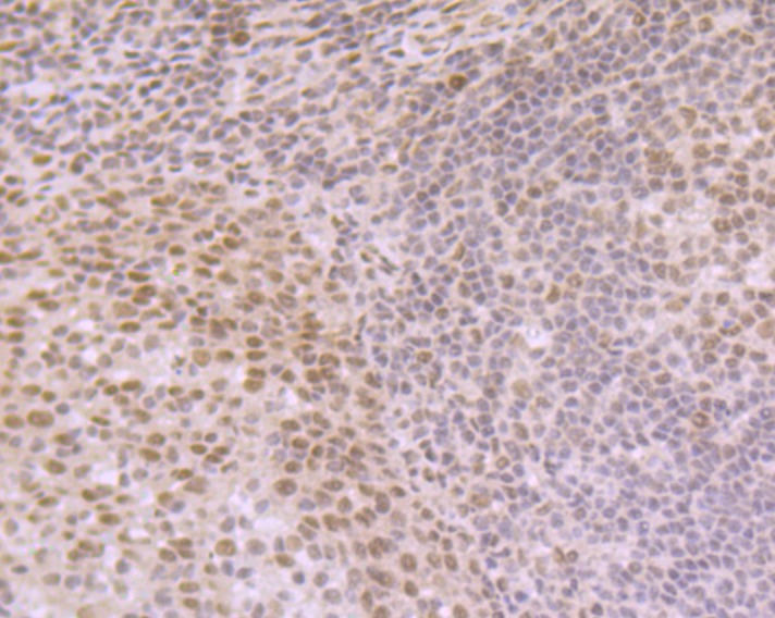 Anti-eIF4A3 Antibody (7D278)