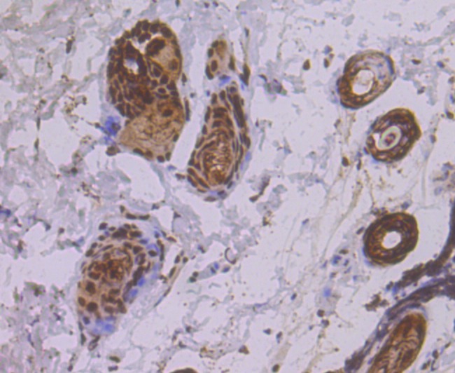 Anti-eIF4A3 Antibody (7D278)