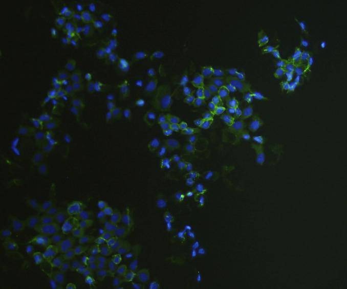 Anti-EpCAM/TROP1 Antibody (9A610)