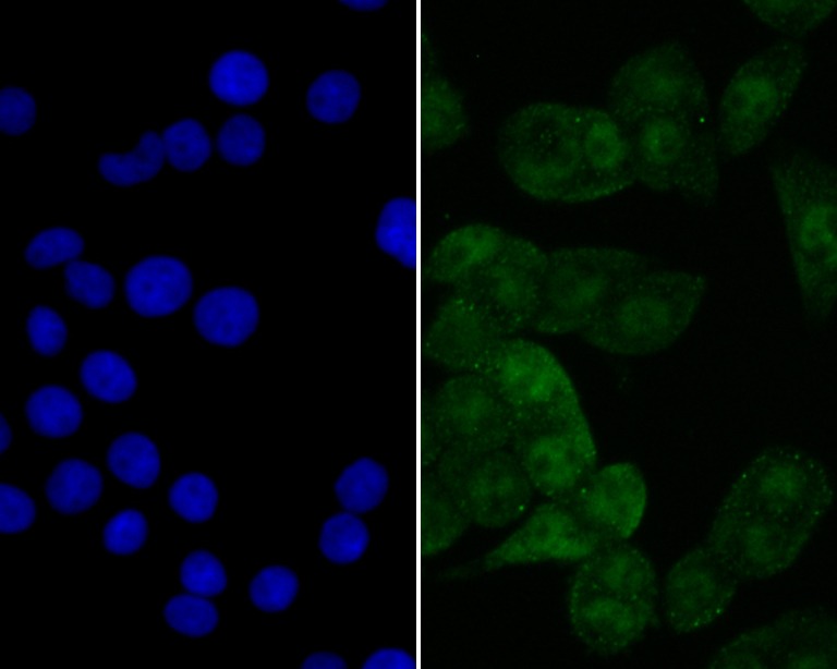 Anti-eIF4A3 Antibody (7D278)