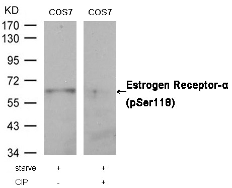 Anti-Phospho-ER alpha (Ser118) Polyclonal Antibody