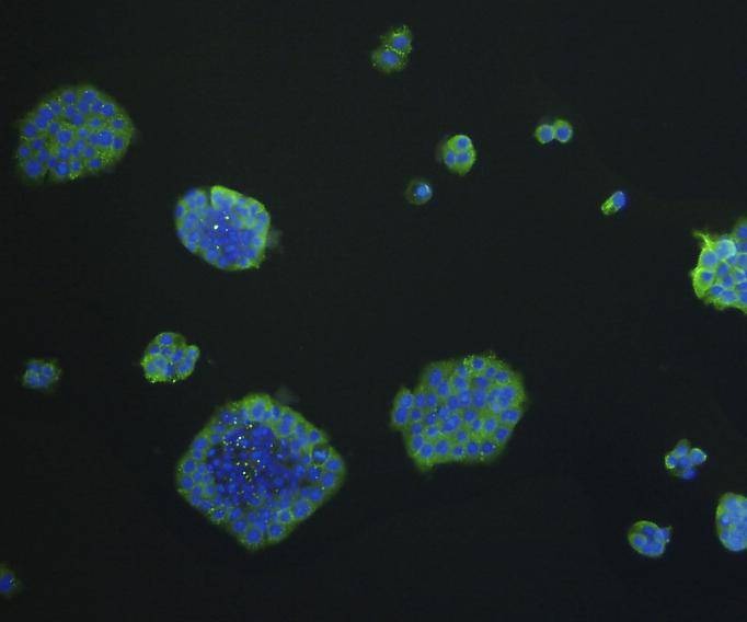 Anti-EpCAM/TROP1 Antibody (9A610)