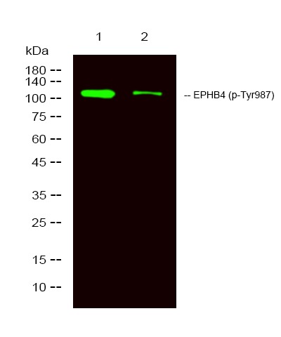 Anti-Phospho-EphB4 (Tyr987) Polyclonal Antibody