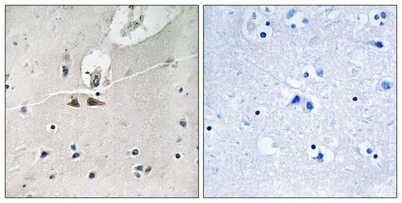 Anti-Phospho-Ephrin B1/2/3 (Tyr324) Polyclonal Antibody 2