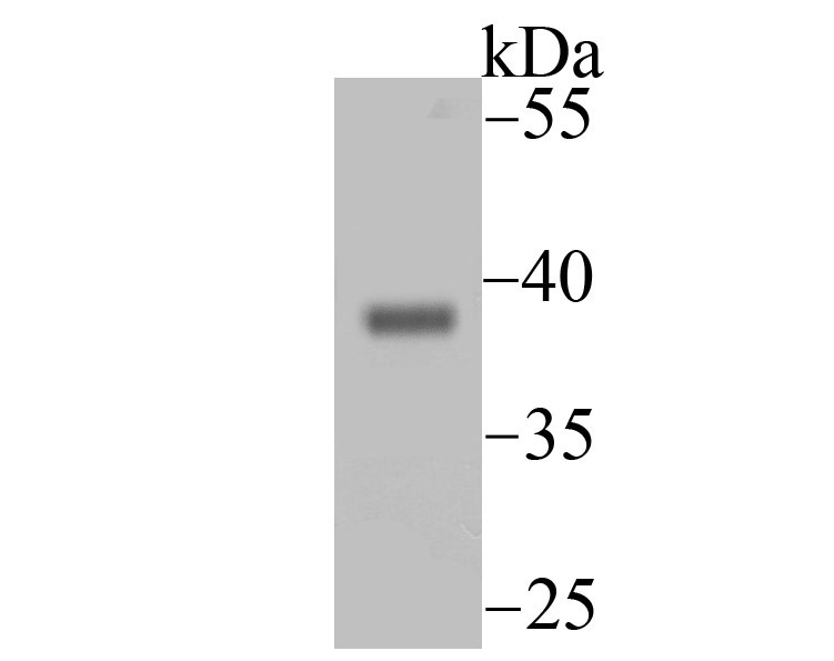 Anti-Endo G Antibody (1O411)
