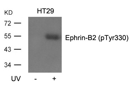 Anti-Phospho-Ephrin B2/EFNB2 (Tyr330) Polyclonal Antibody