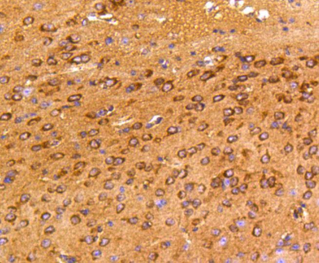 Anti-PTK2 Antibody (4L758)