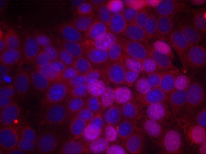 Anti-Phospho-ER alpha (Ser106) Polyclonal Antibody