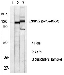 Anti-Phospho-EphB1/2 (Tyr594/604) Polyclonal Antibody