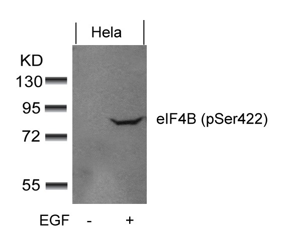 Anti-Phospho-eIF4B (Ser422) Polyclonal Antibody