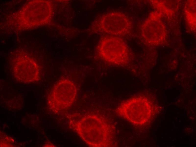 Anti-Phospho-EIF4E (Ser209) Polyclonal Antibody