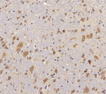 Anti-Phospho-PTK2 (Tyr397) Polyclonal Antibody